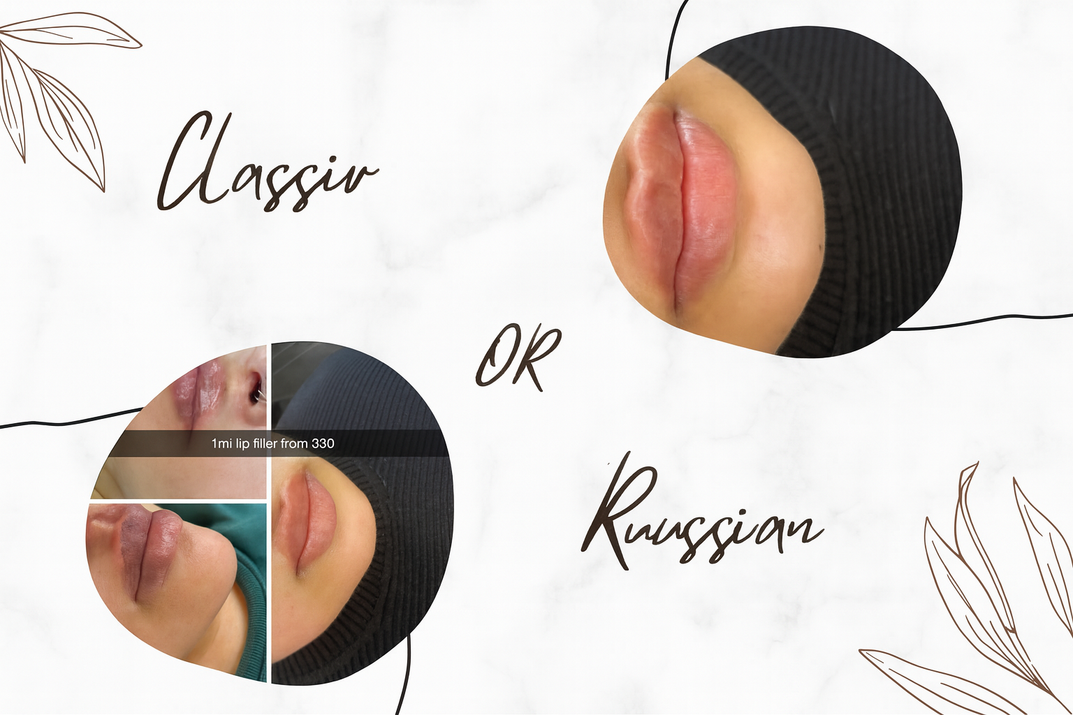 Lip Enhancement treatment